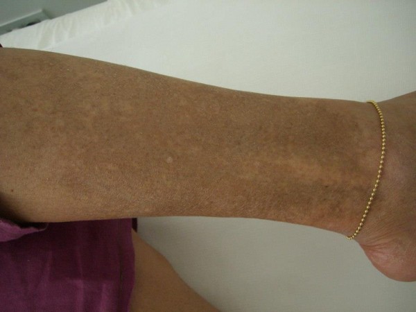 Before image