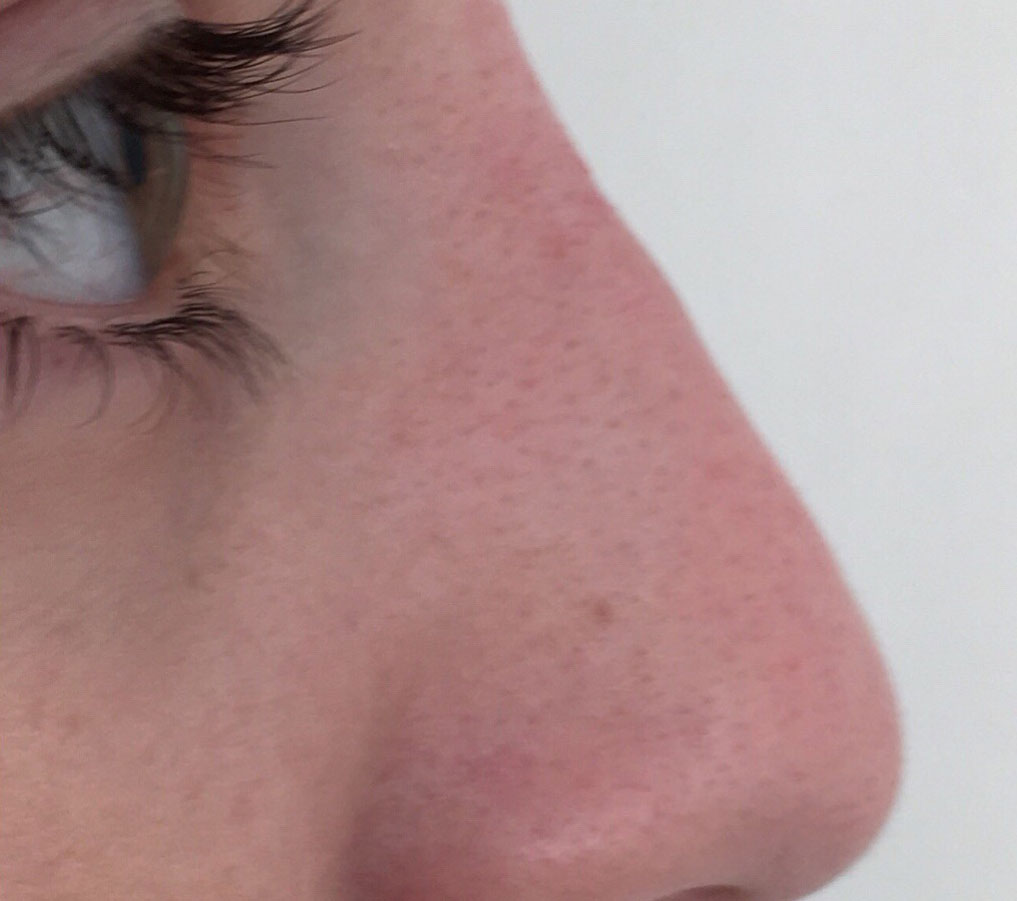 After image
