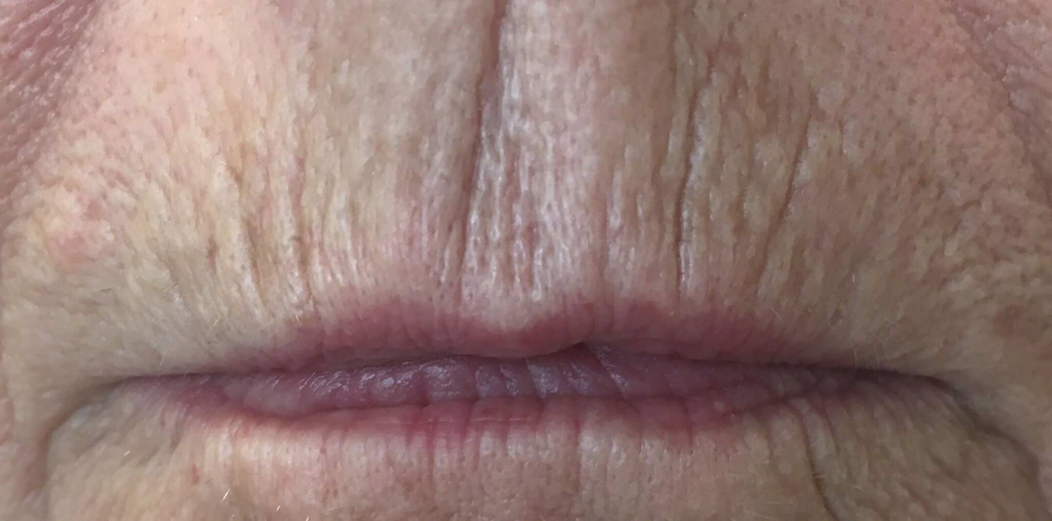 Before image
