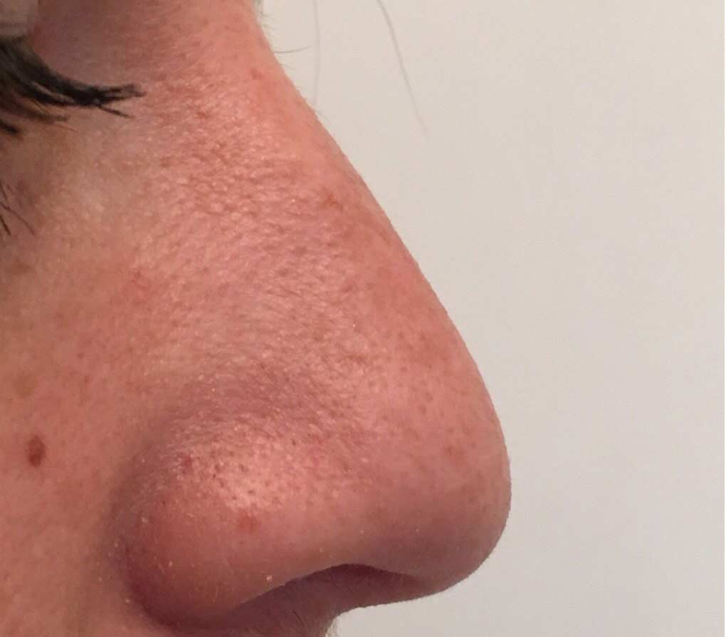 Before image