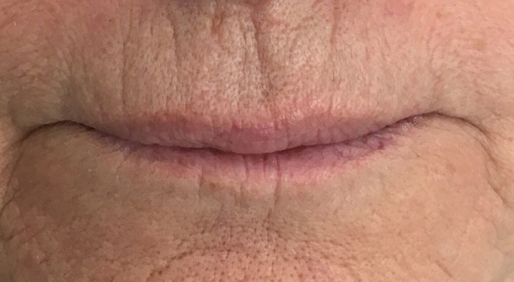 Before image