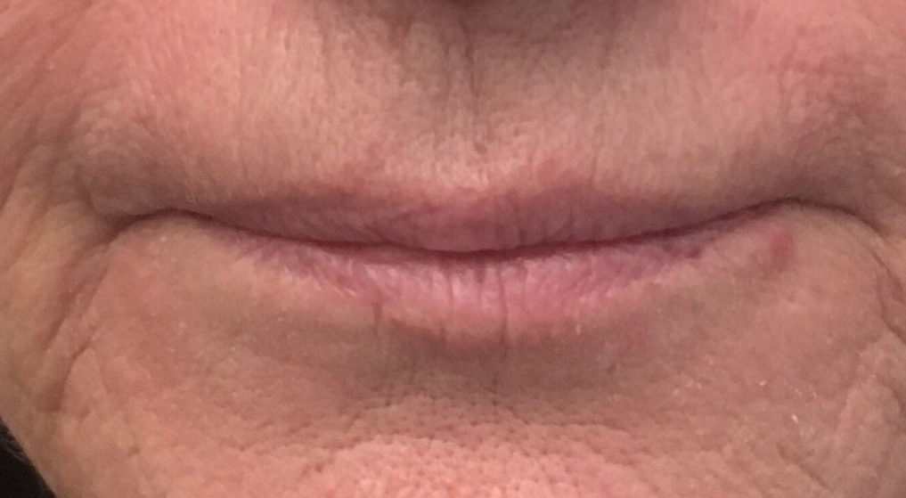 After image