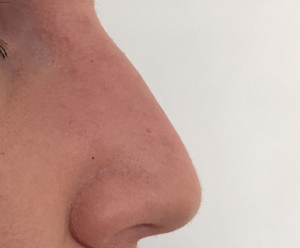 Before image