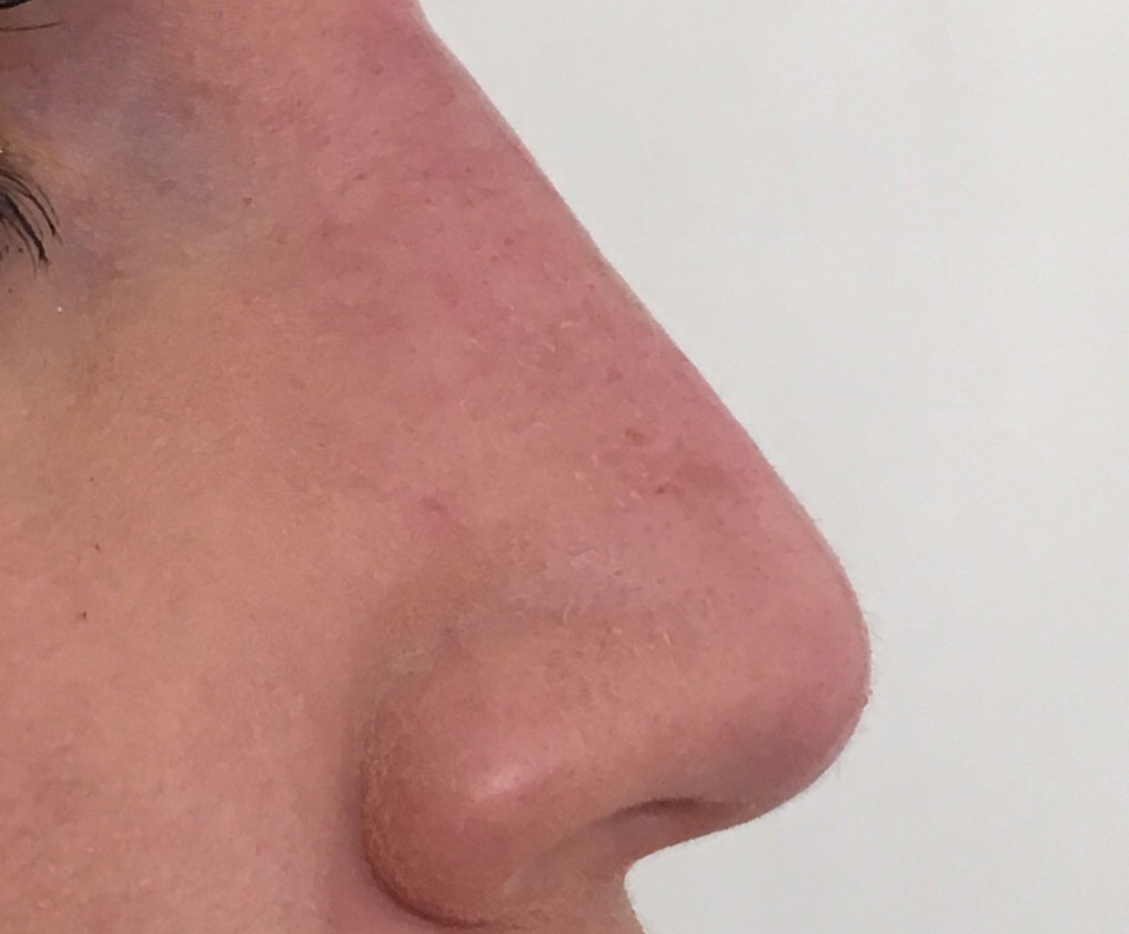 After image