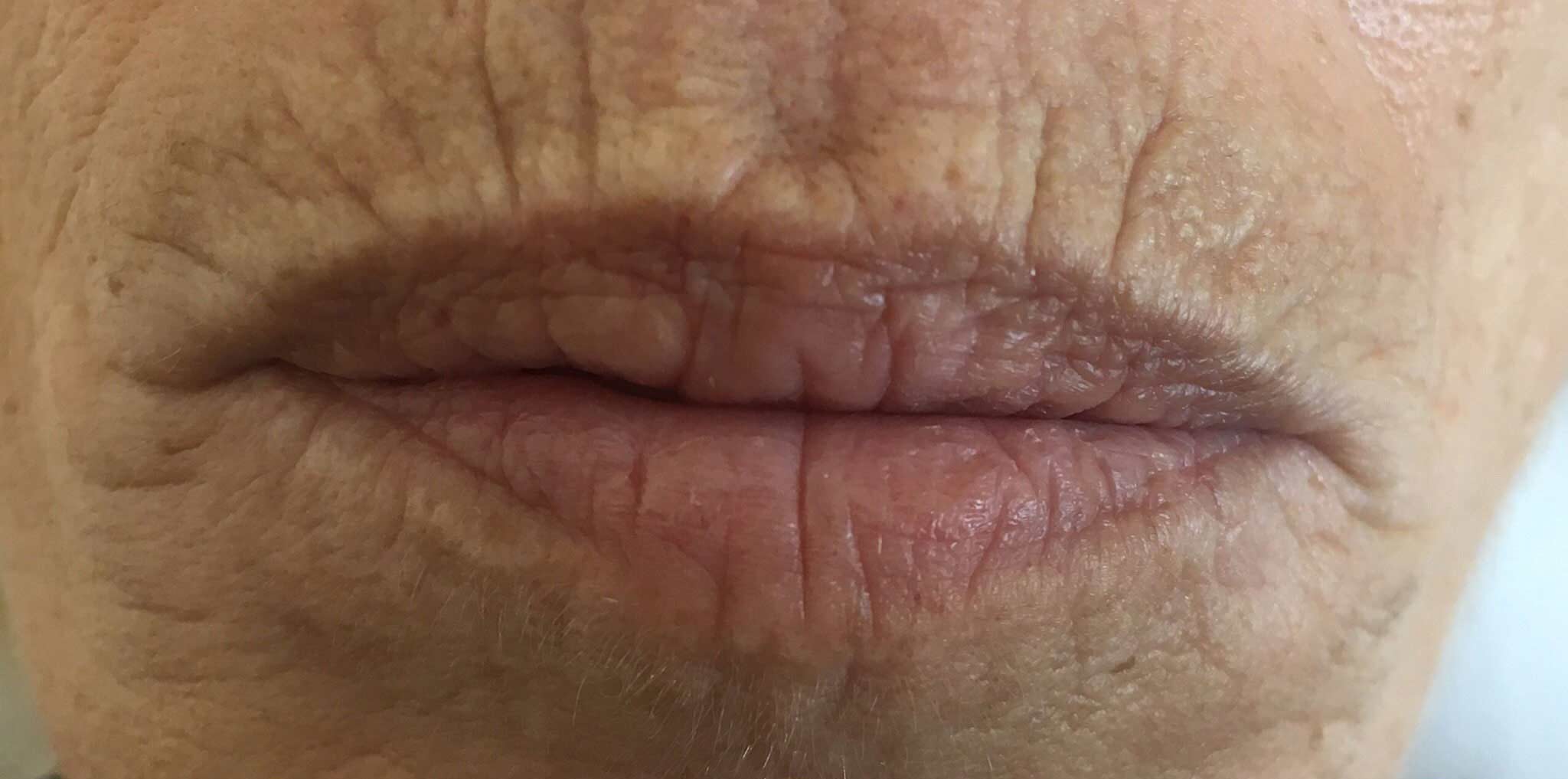 Before image