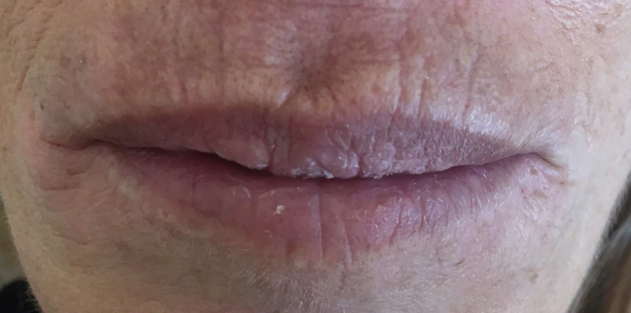 After image