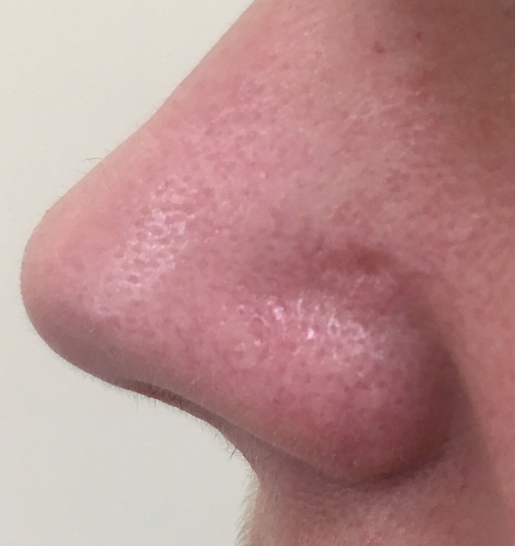 After image